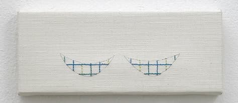 What happen ? You make like litte hammocks under your eyes!